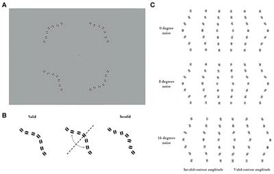Examen integral de lesión cerebral traumática (tbi) versión integral Examen integral de lesión cerebral traumática (tbi) versión integral